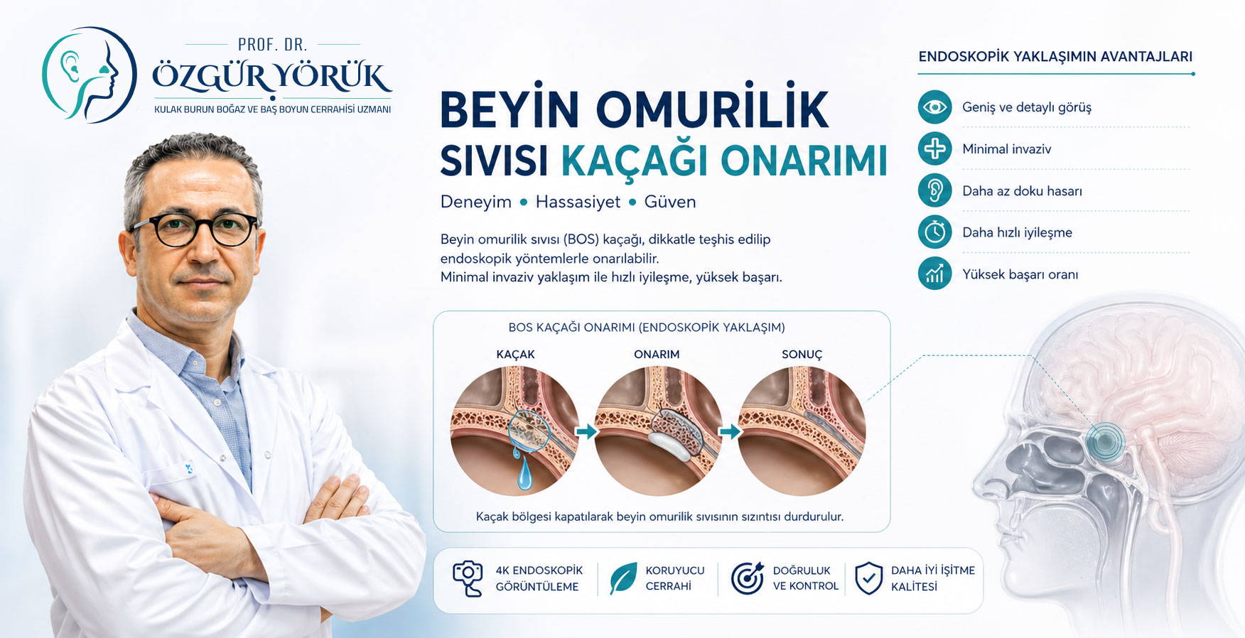 Beyin Omurilik Sıvısı Kaçağı Onarımı