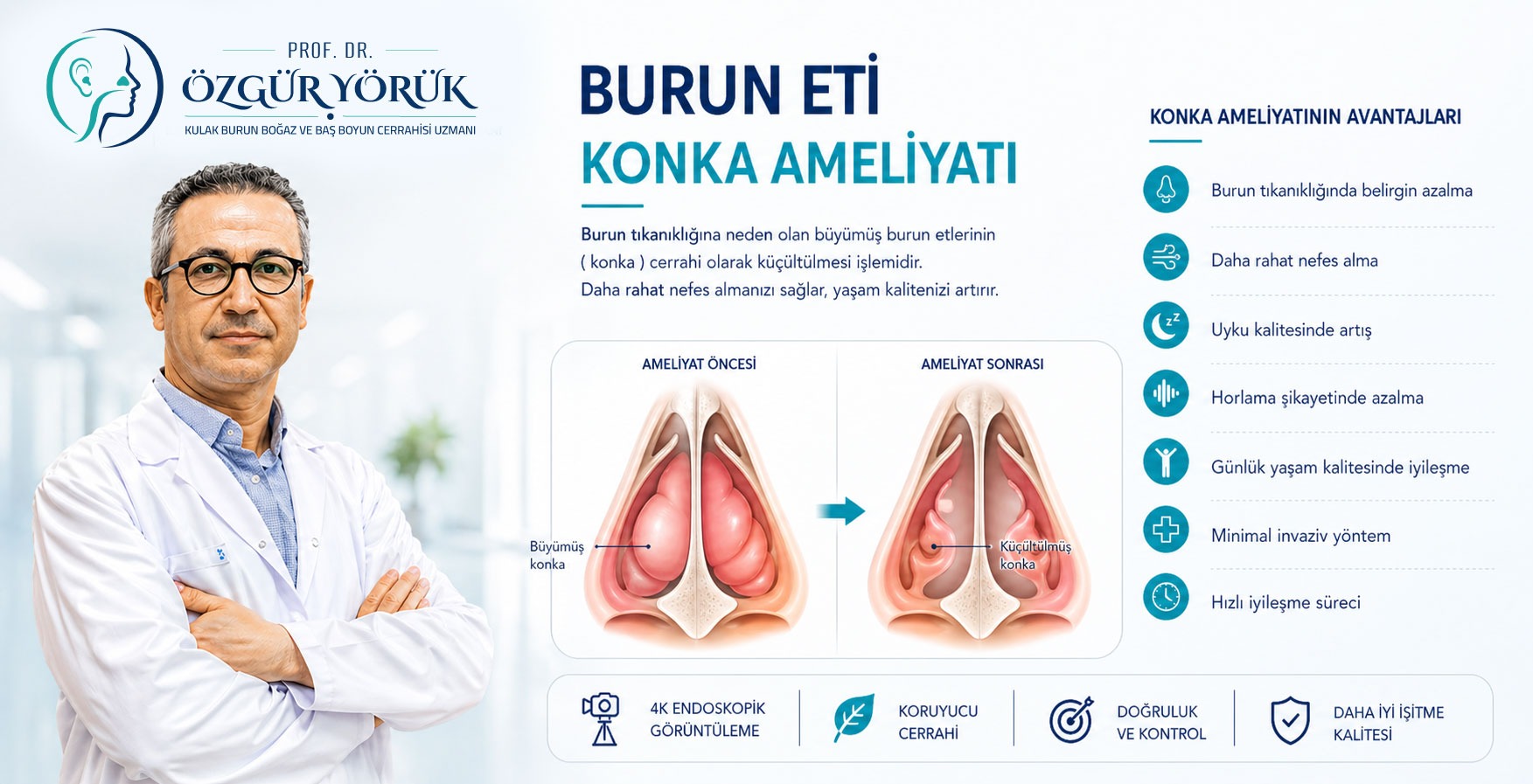 Burun Eti (Konka) Ameliyatı
