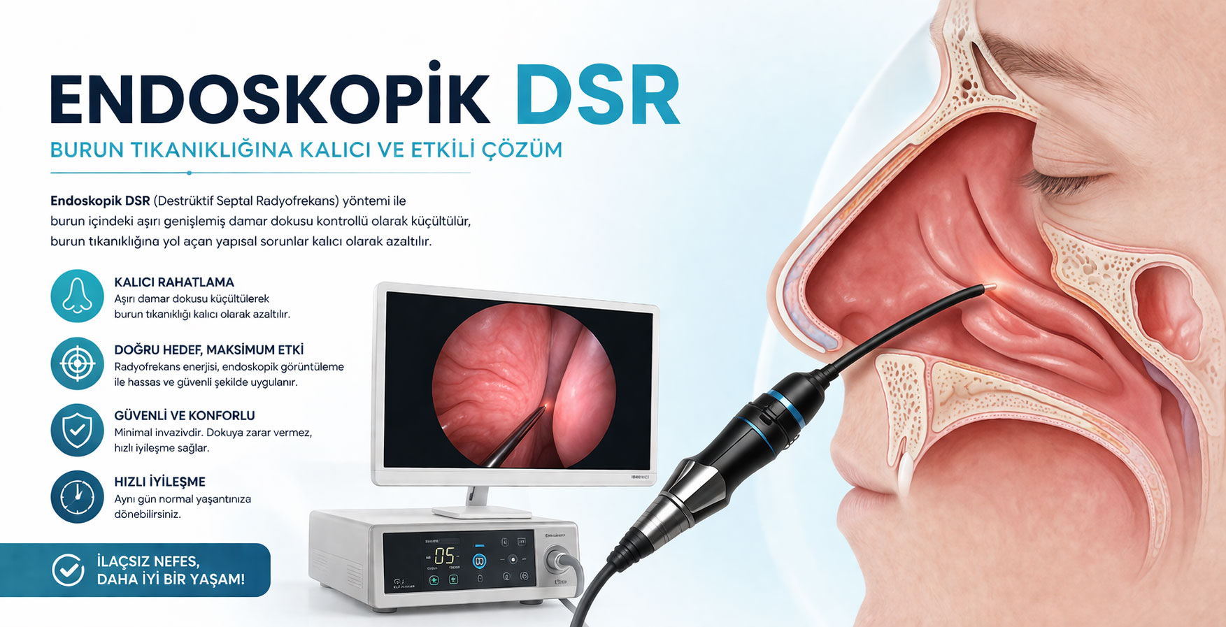 Endoskopik DSR (Gözyaşı Kanalı Tıkanıklığı Ameliyatı)