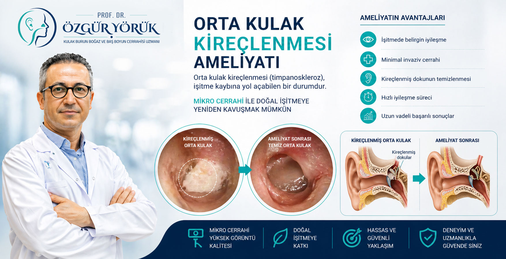 Orta Kulak Kireçlenmesi Ameliyatı