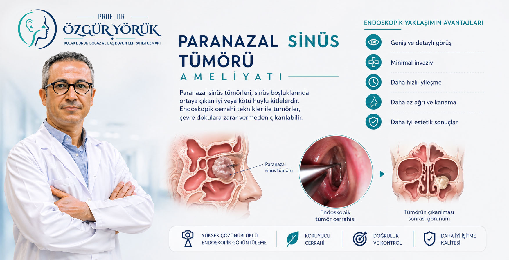 Paranazal Sinüs Tümörü Ameliyatı