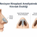 Revizyon Rinoplasti Ameliyatında Kıkırdak Eksikliği