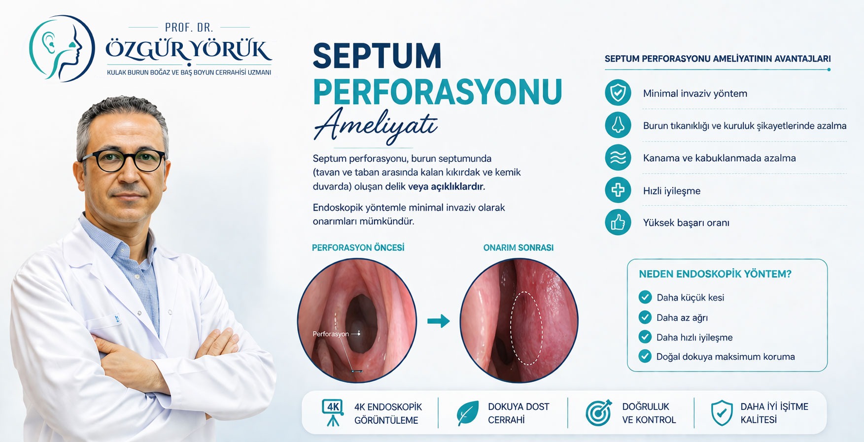 Septum Perforasyonu Ameliyatı