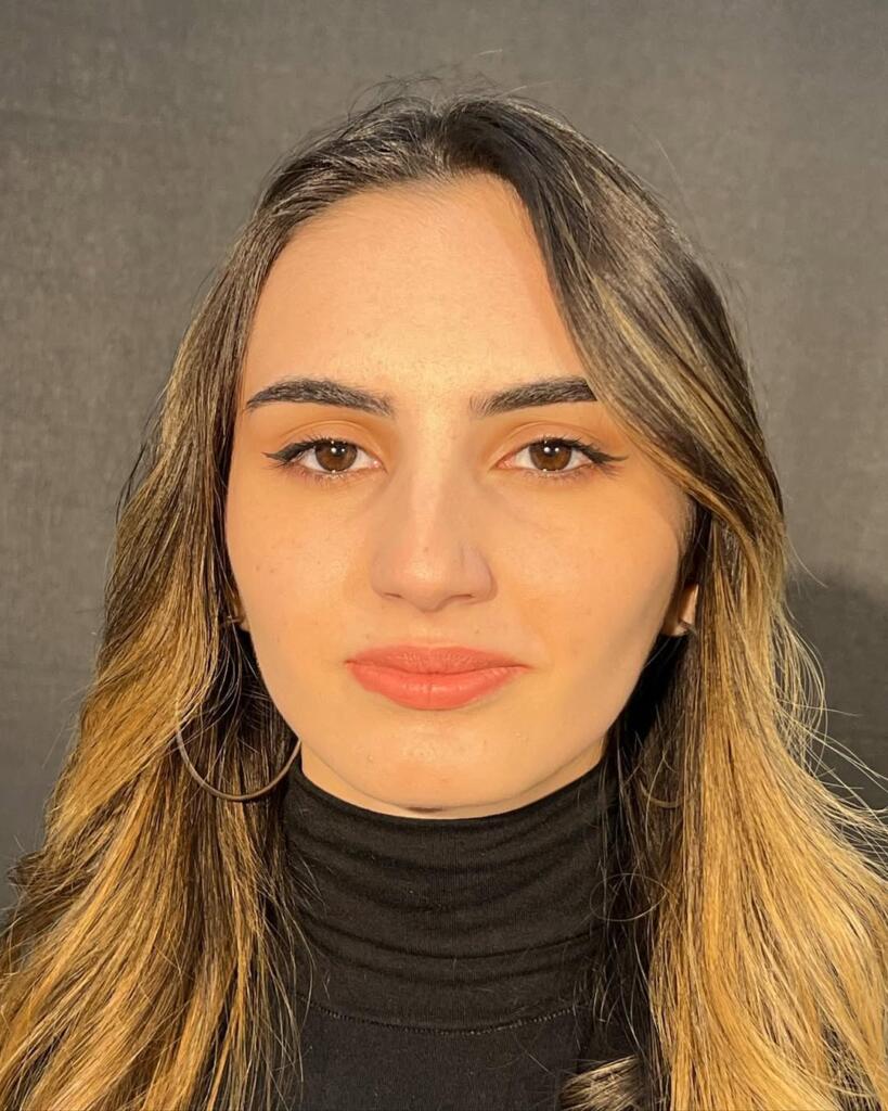 burun estetiği operasyonu öncesi