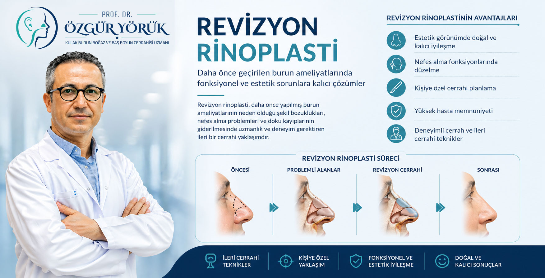 Revizyon Rinoplasti