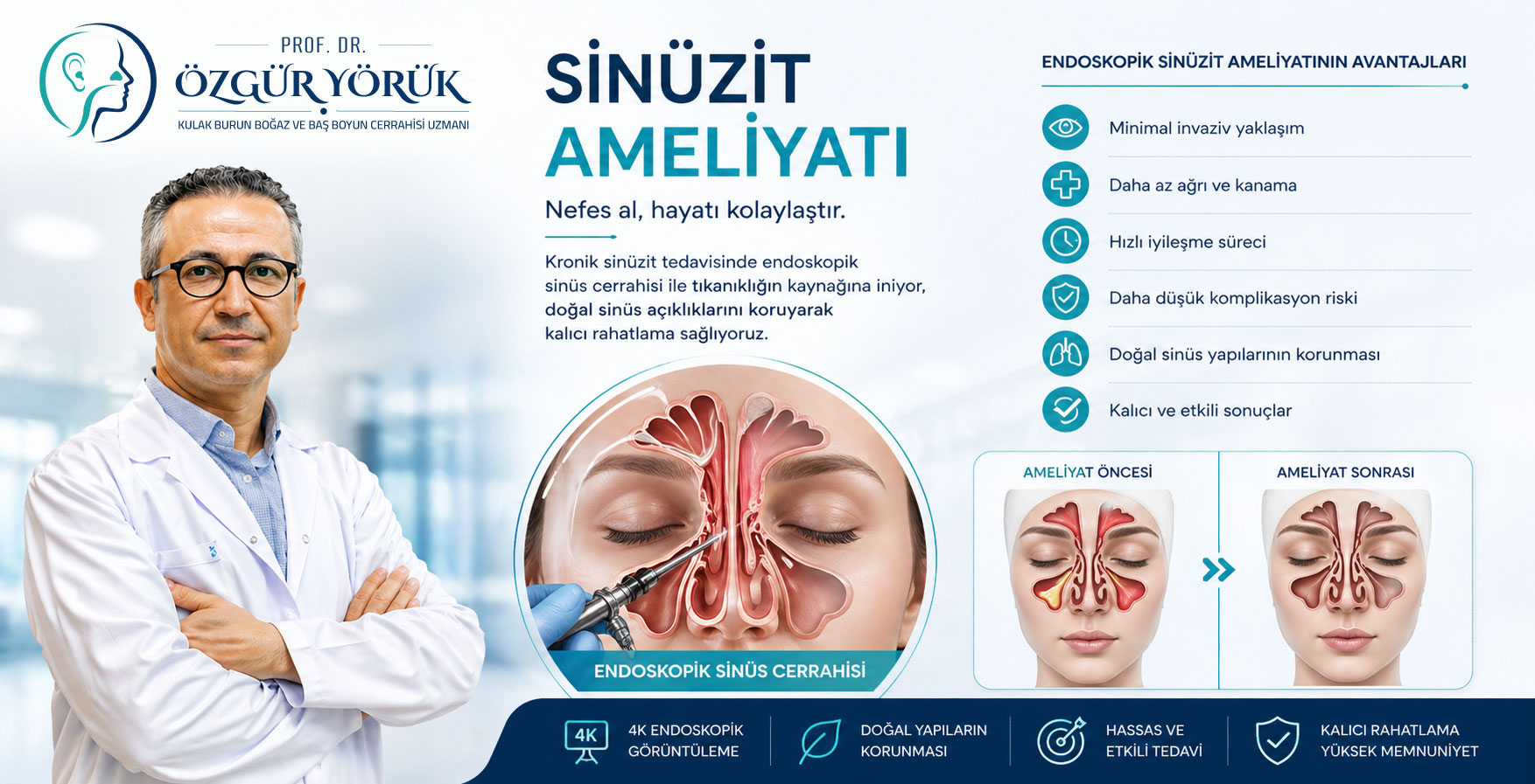 Sinüzit Ameliyatı