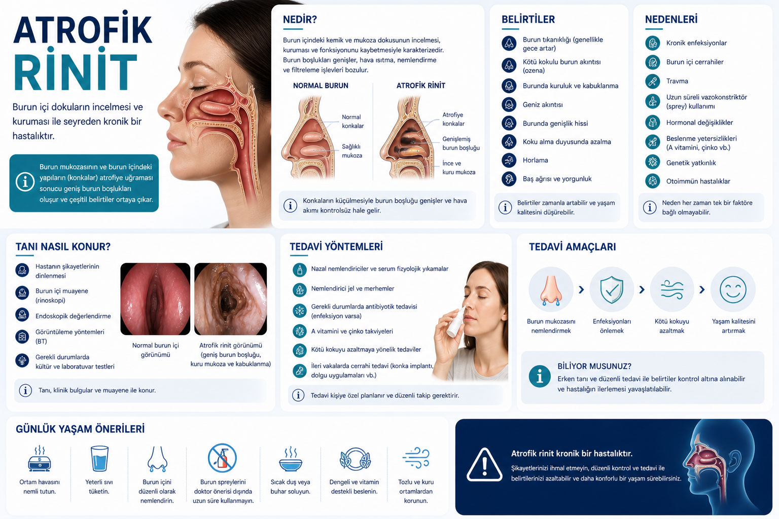 Atrofik rinit