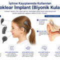 İşitme Kayıplarında Kullanılan Koklear İmplant (Biyonik Kulak) Nedir?