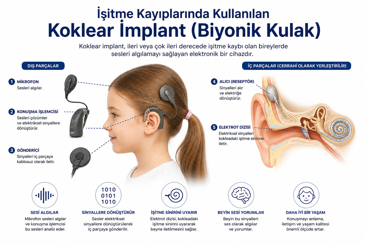 İşitme Kayıplarında Kullanılan Koklear İmplant (Biyonik Kulak) Nedir?