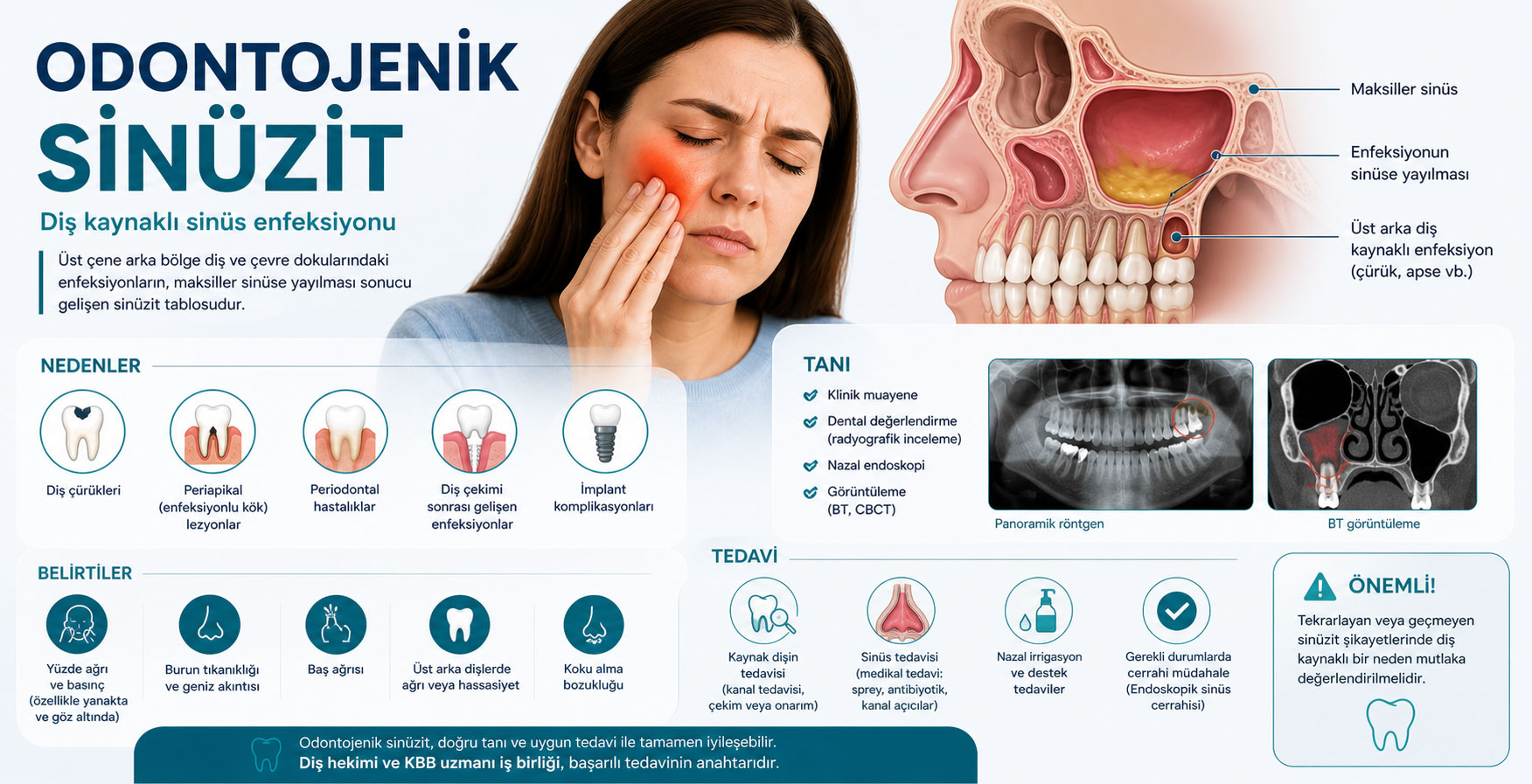 Odontojenik Sinüzit