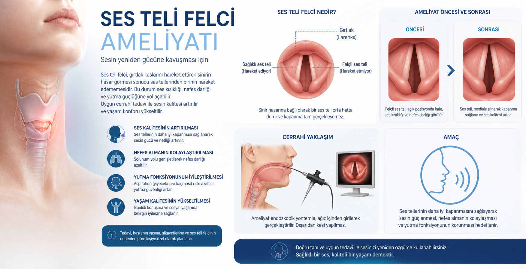 Ses Teli Felci Ameliyatı
