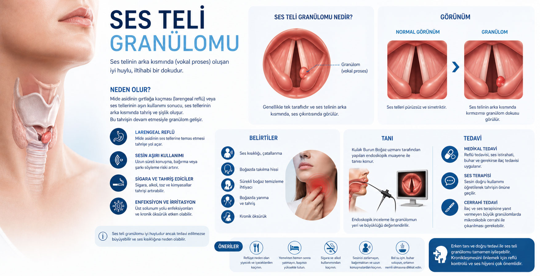 Ses Teli Granülomu