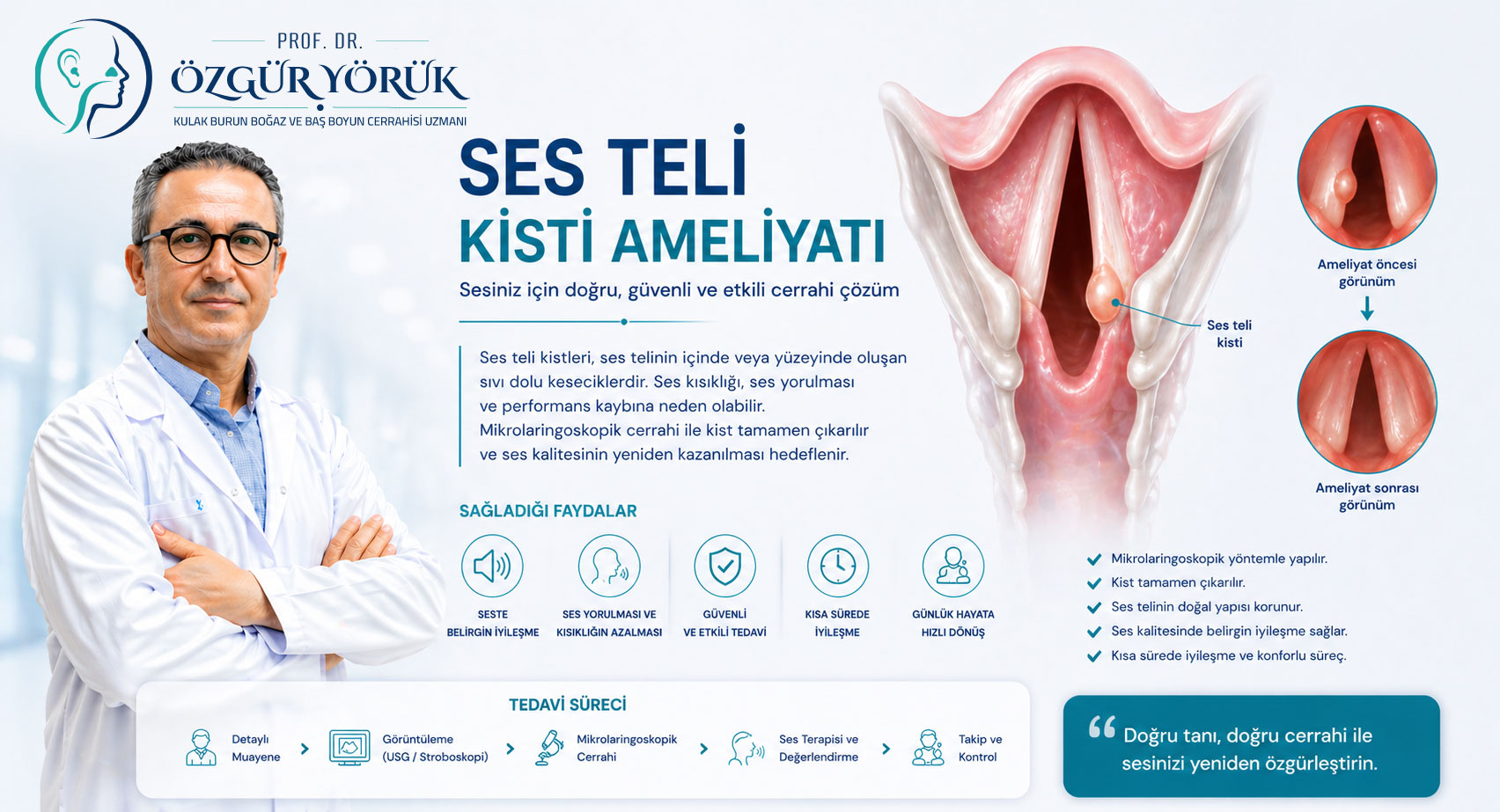 Ses Teli Kisti Ameliyatı