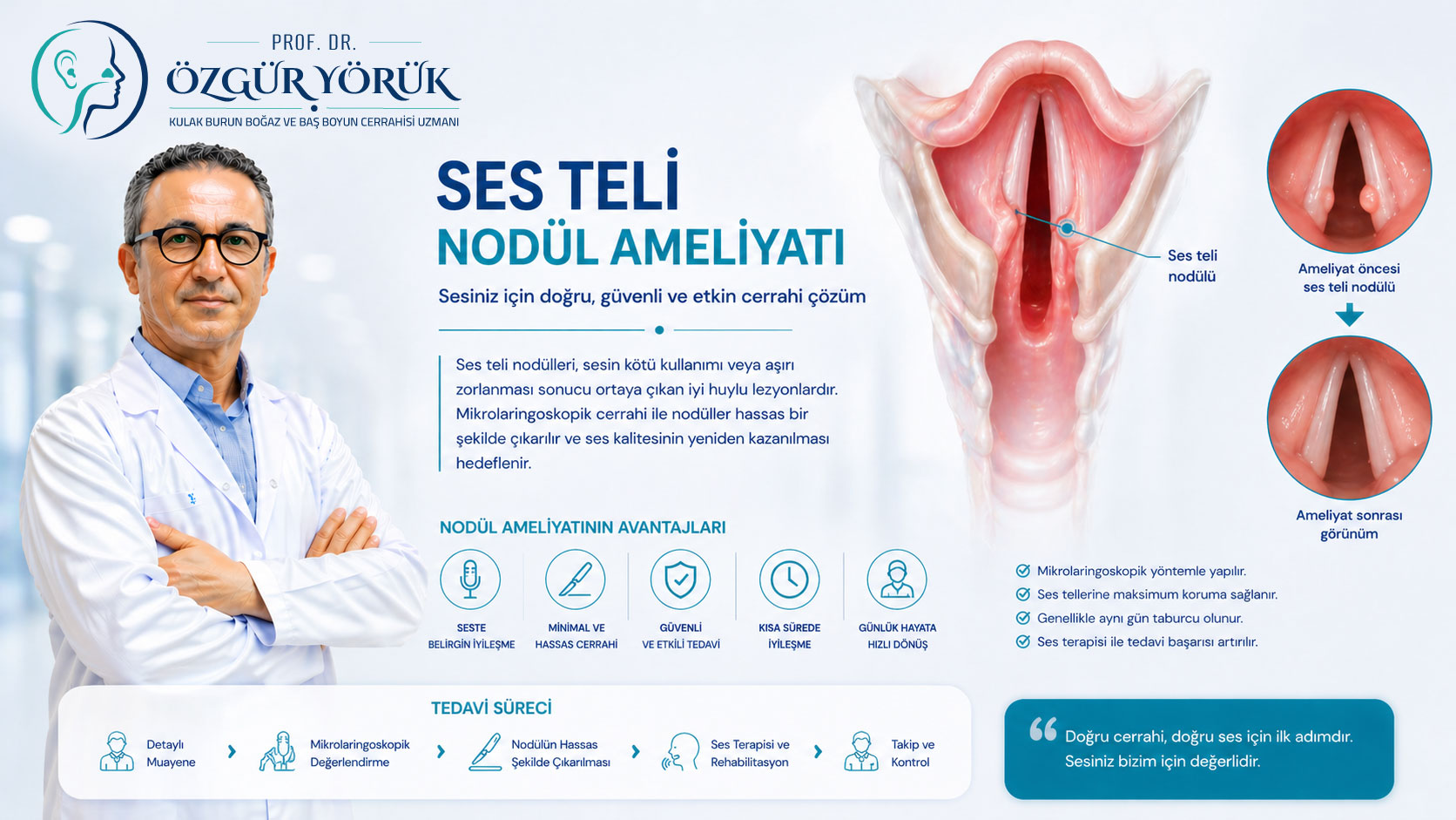 Ses Teli Nodül Ameliyatı
