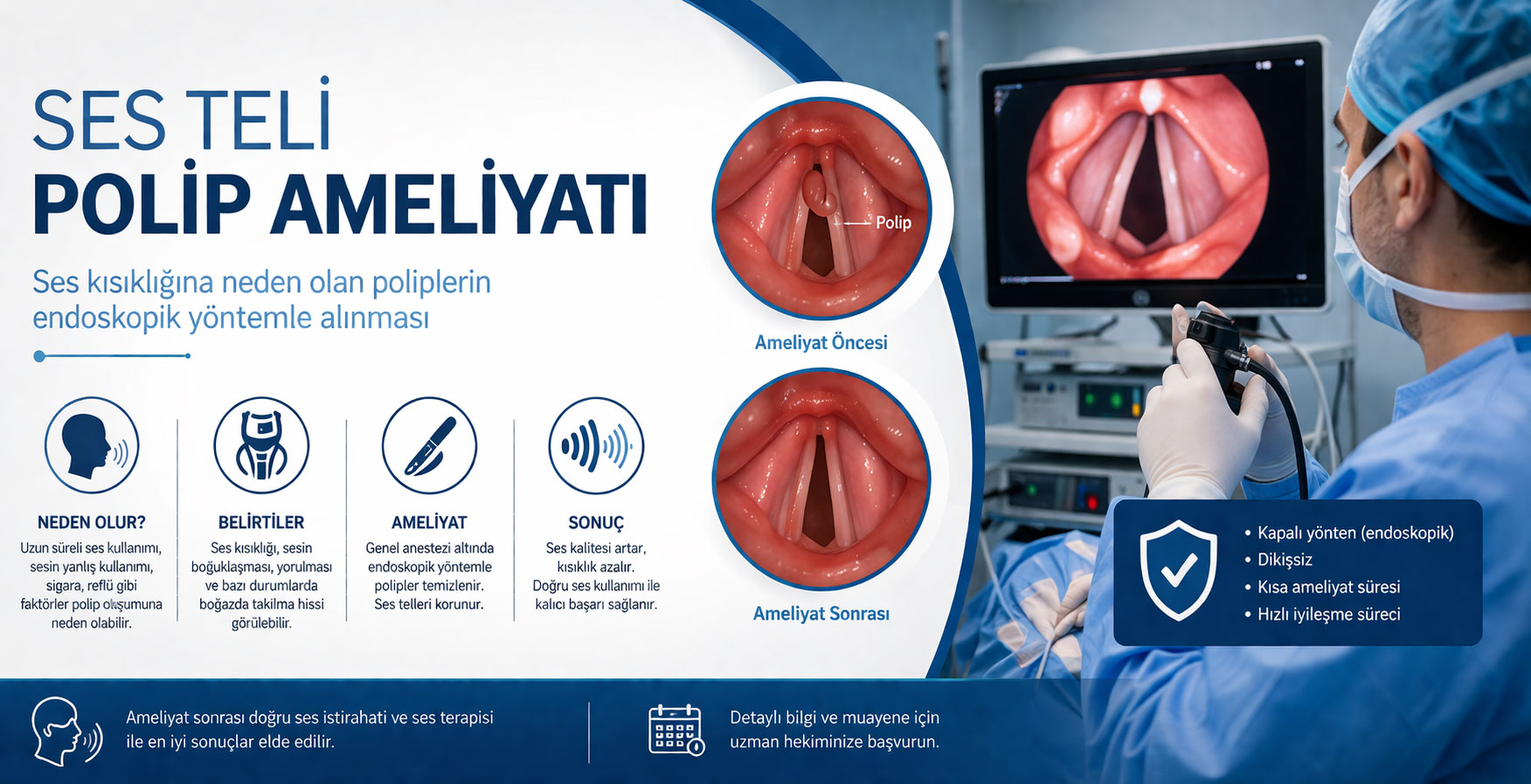 Ses Teli Polip Ameliyatı