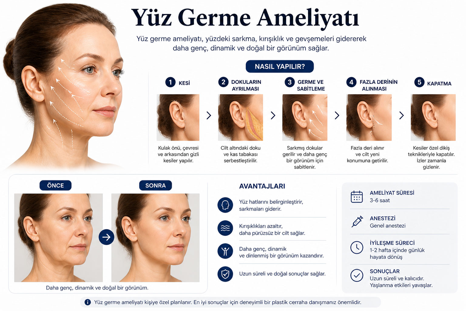 Yüz Germe Ameliyatı